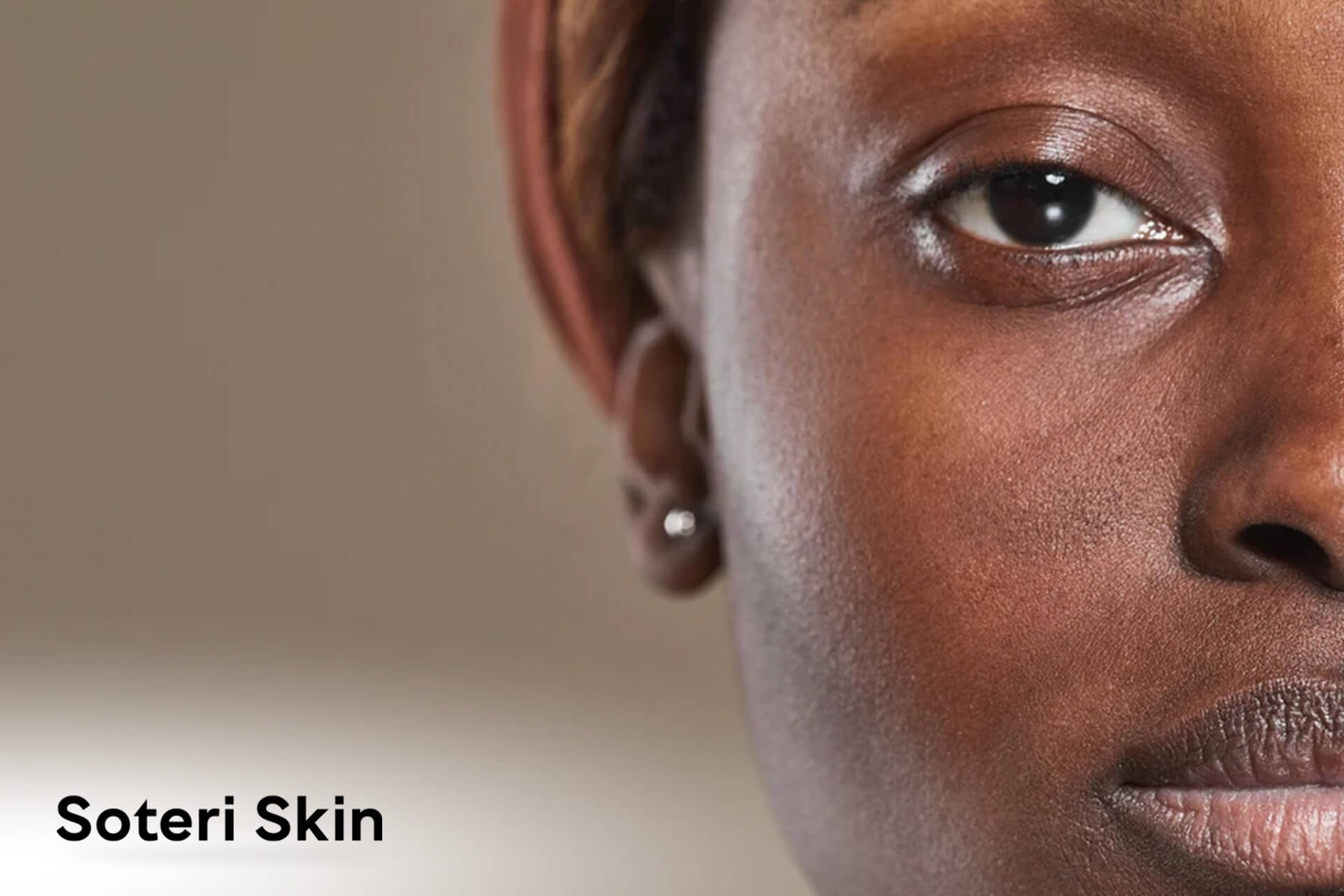 Eczema on Black Skin: Symptoms, Treatment, and Care Tips