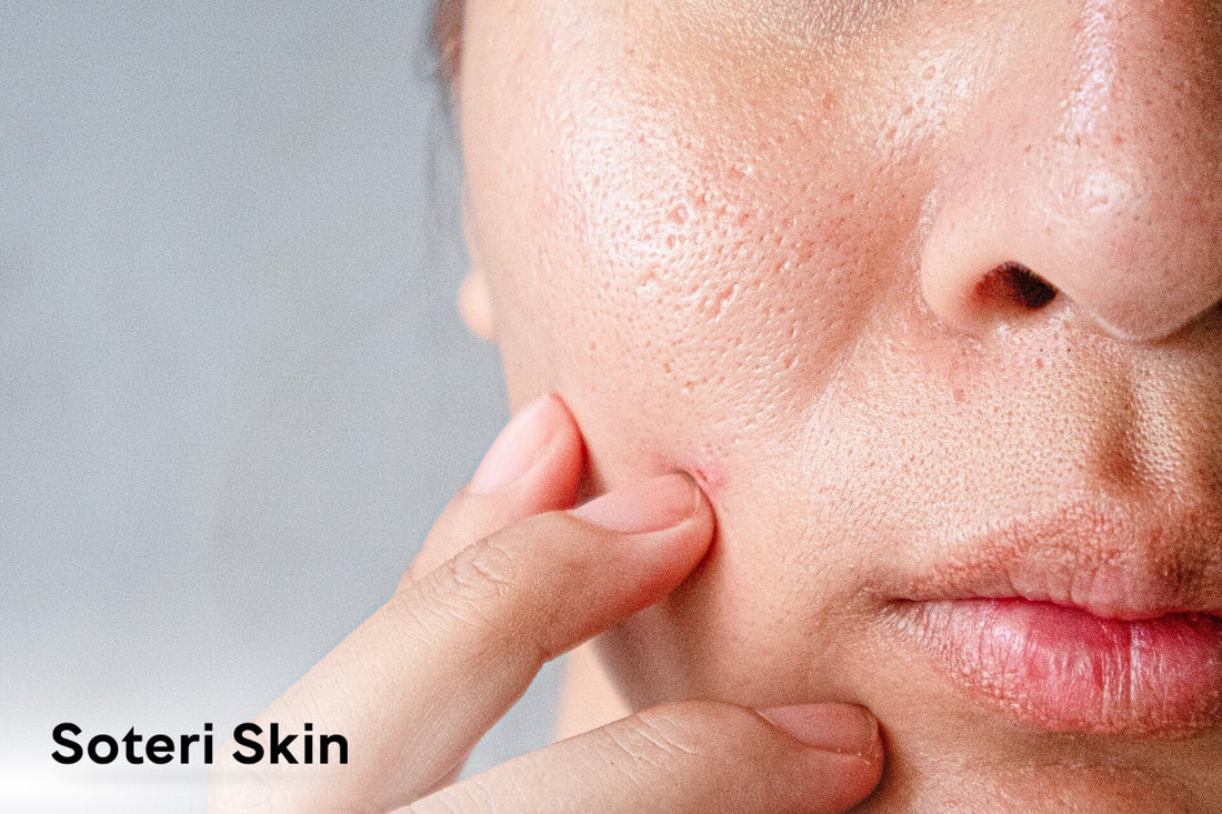Dry Skin: Types, Causes, Symptoms, and Care Essentials