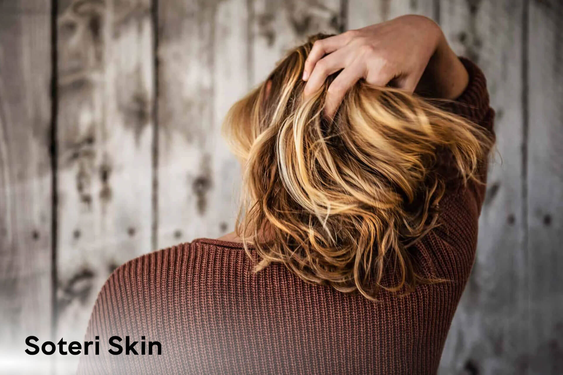 Psoriasis vs. Seborrheic Dermatitis: Differences Explained