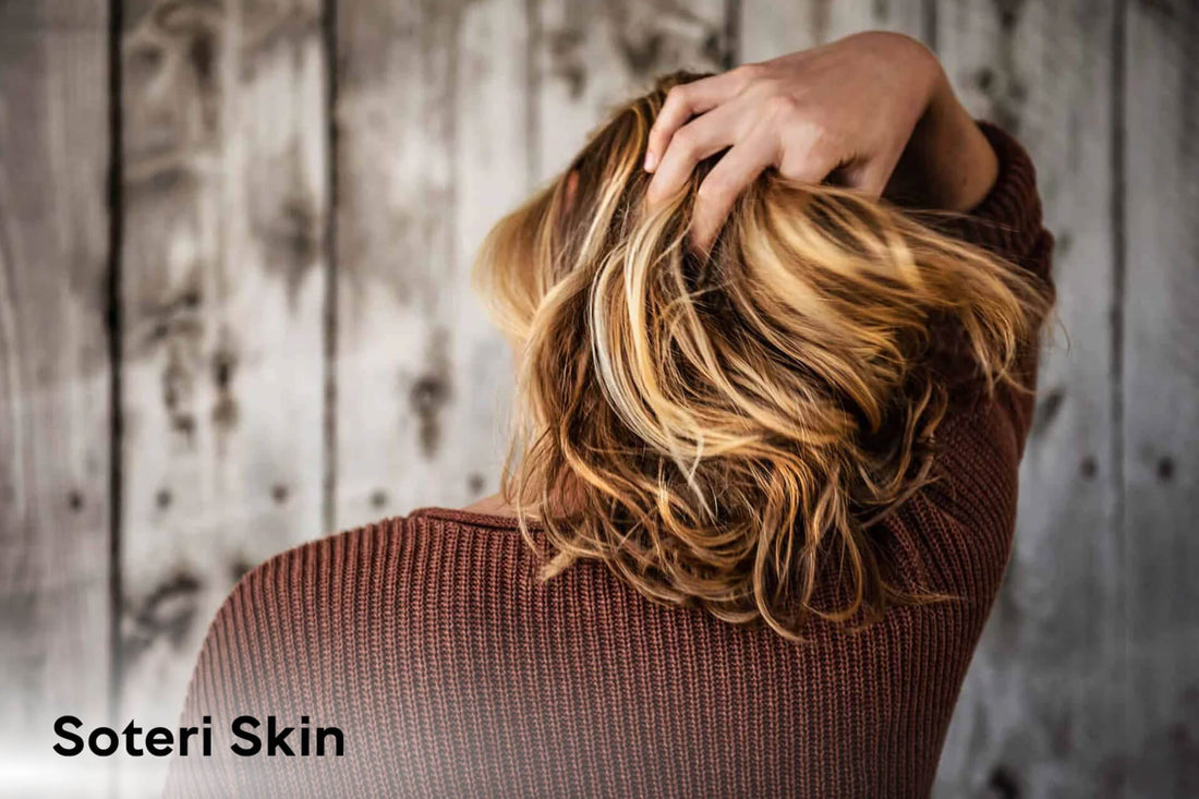 Psoriasis vs. Seborrheic Dermatitis: Differences Explained