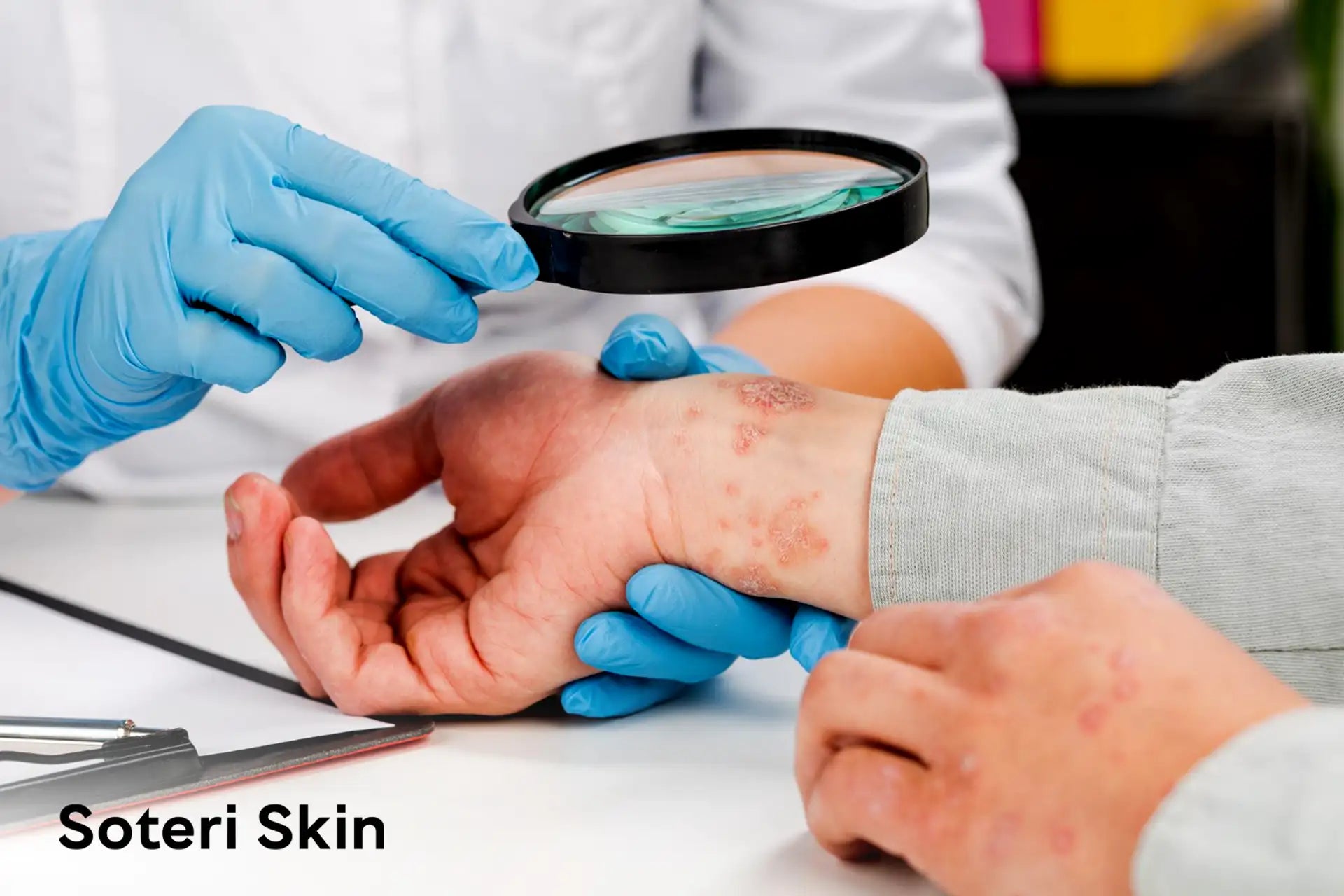 Contact Dermatitis Symptoms, Causes, Treatment & Healing Stages