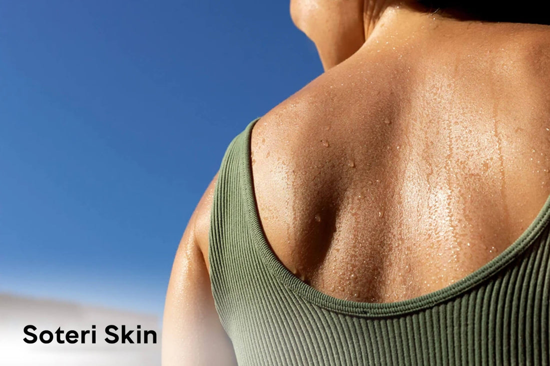 Heat Rash and Related Skin Irritation