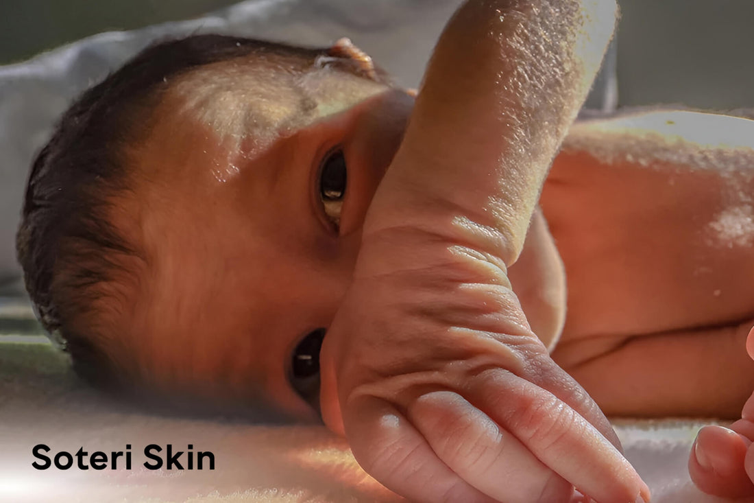 Newborn Dry Skin : Causes, Remedies, and Prevention Tips