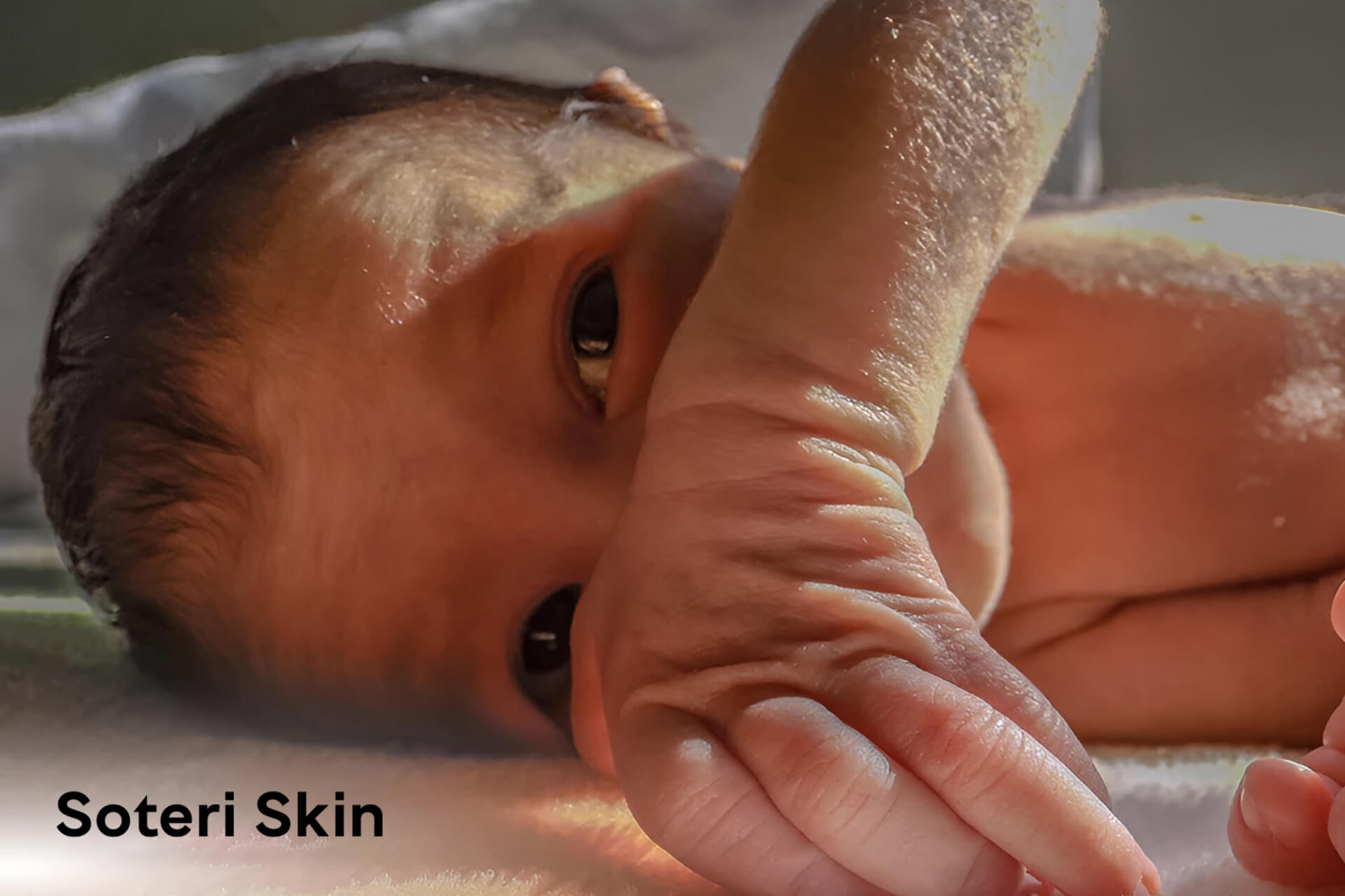 Newborn Dry Skin : Causes, Remedies, and Prevention Tips