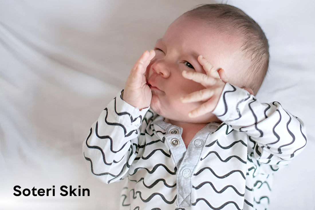 Why Babies Scratch Their Faces: A Parent’s Guide to Causes, Care, and Prevention