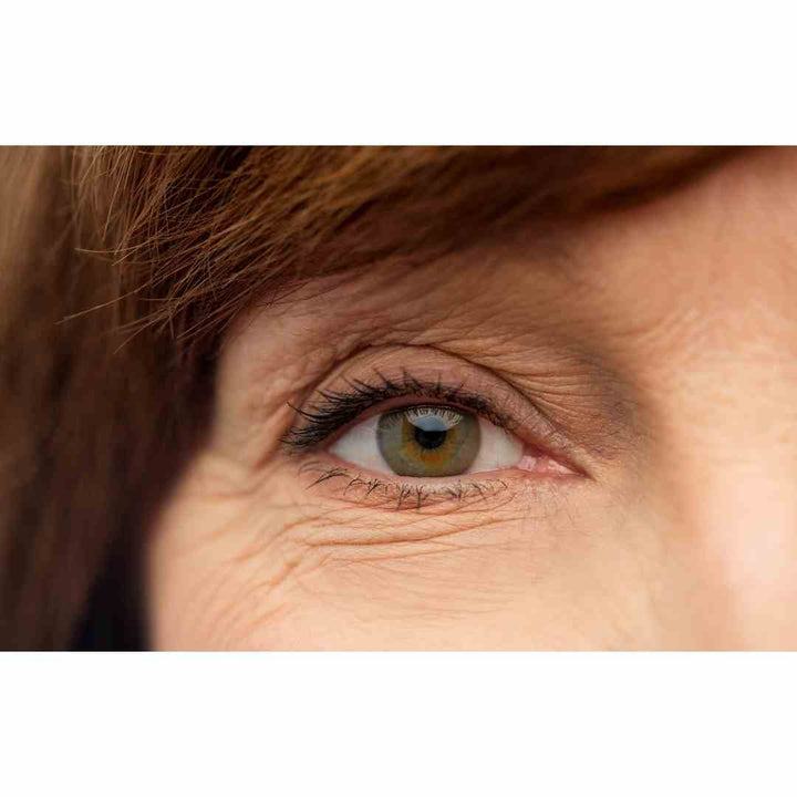 older brunette woman with dry eyes sjogrens syndrome