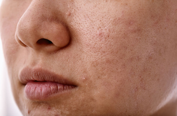 close up of a nose showing sebum and pores