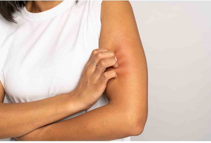 woman scratching at her arm wearing white cotton tshirt