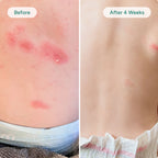Baby Eczema Relief Cream