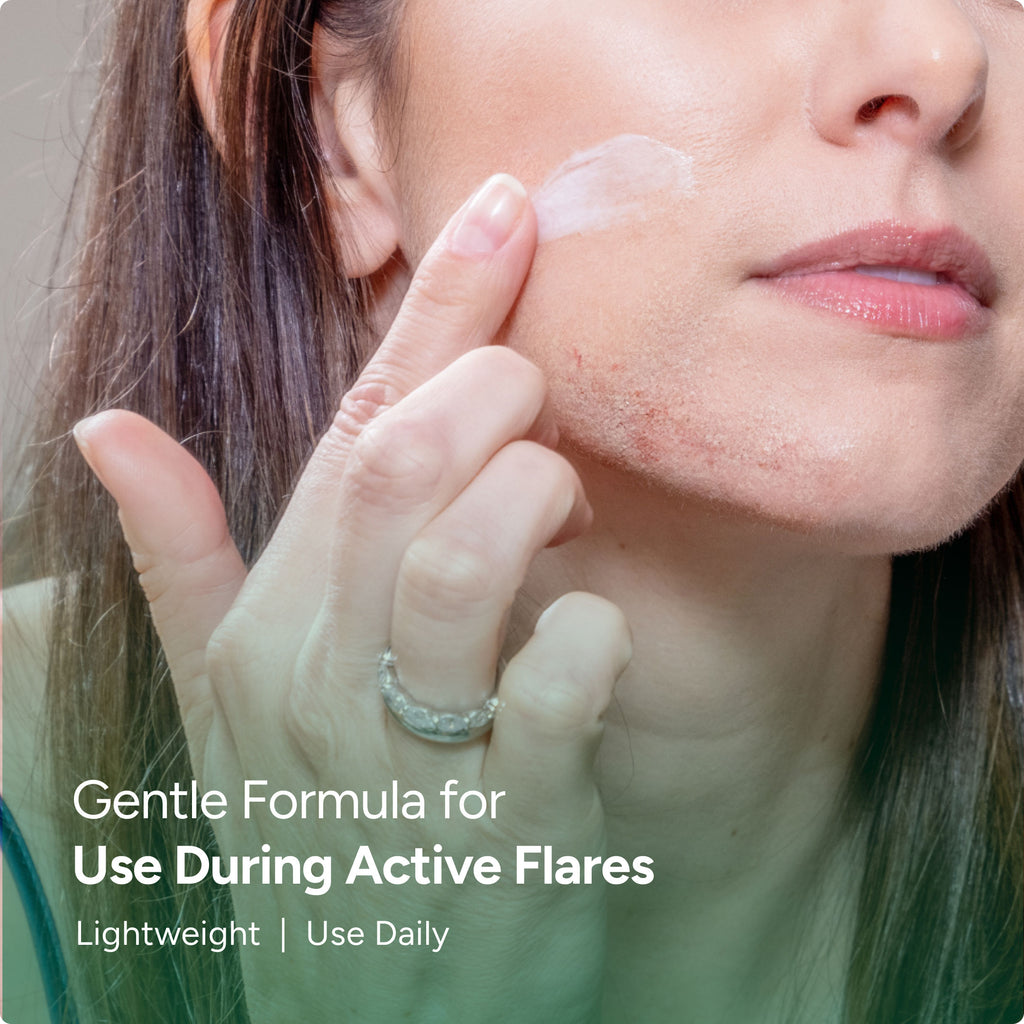 Active Flare-Up Eczema Relief Cream