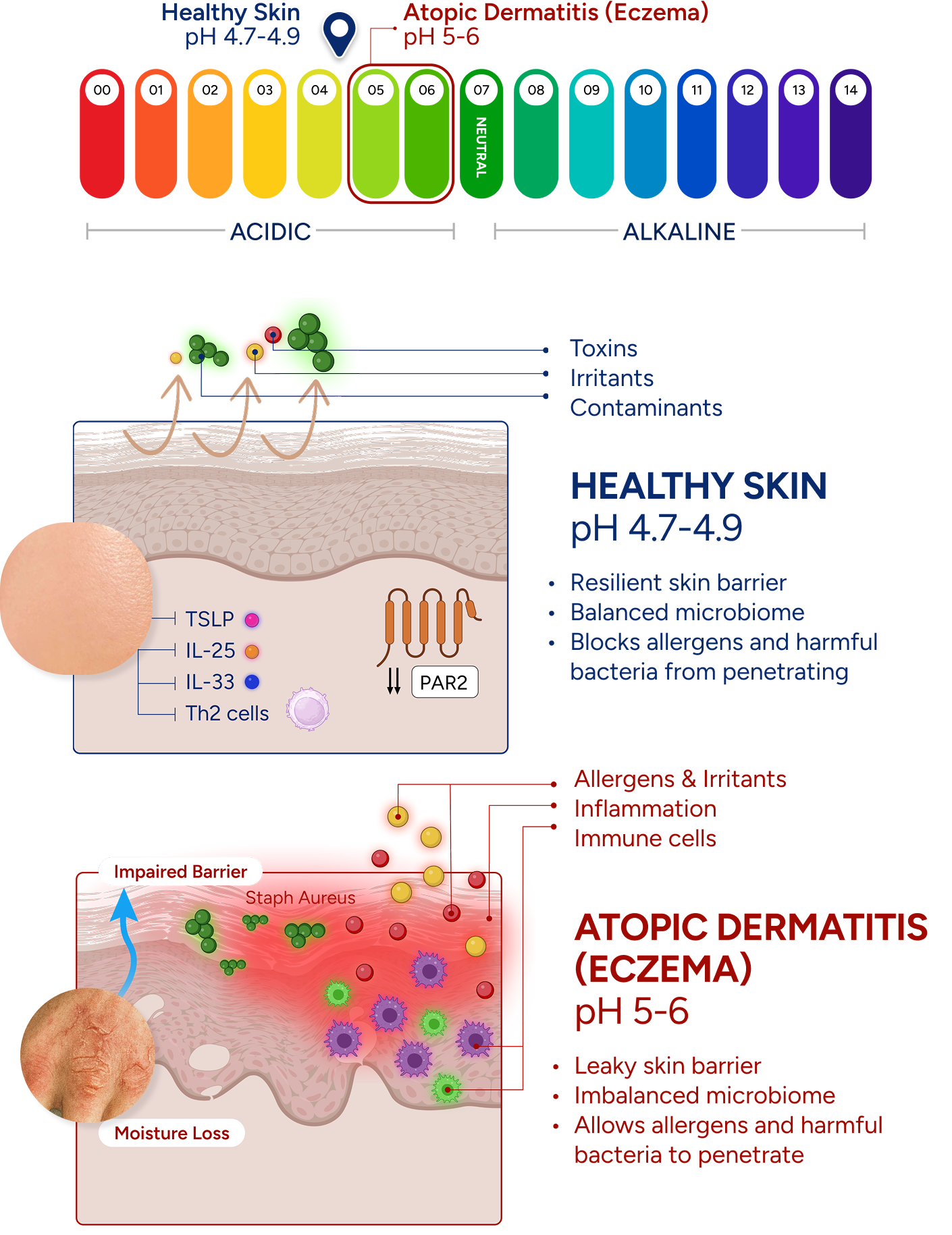 Why Skin pH Matters in Eczema