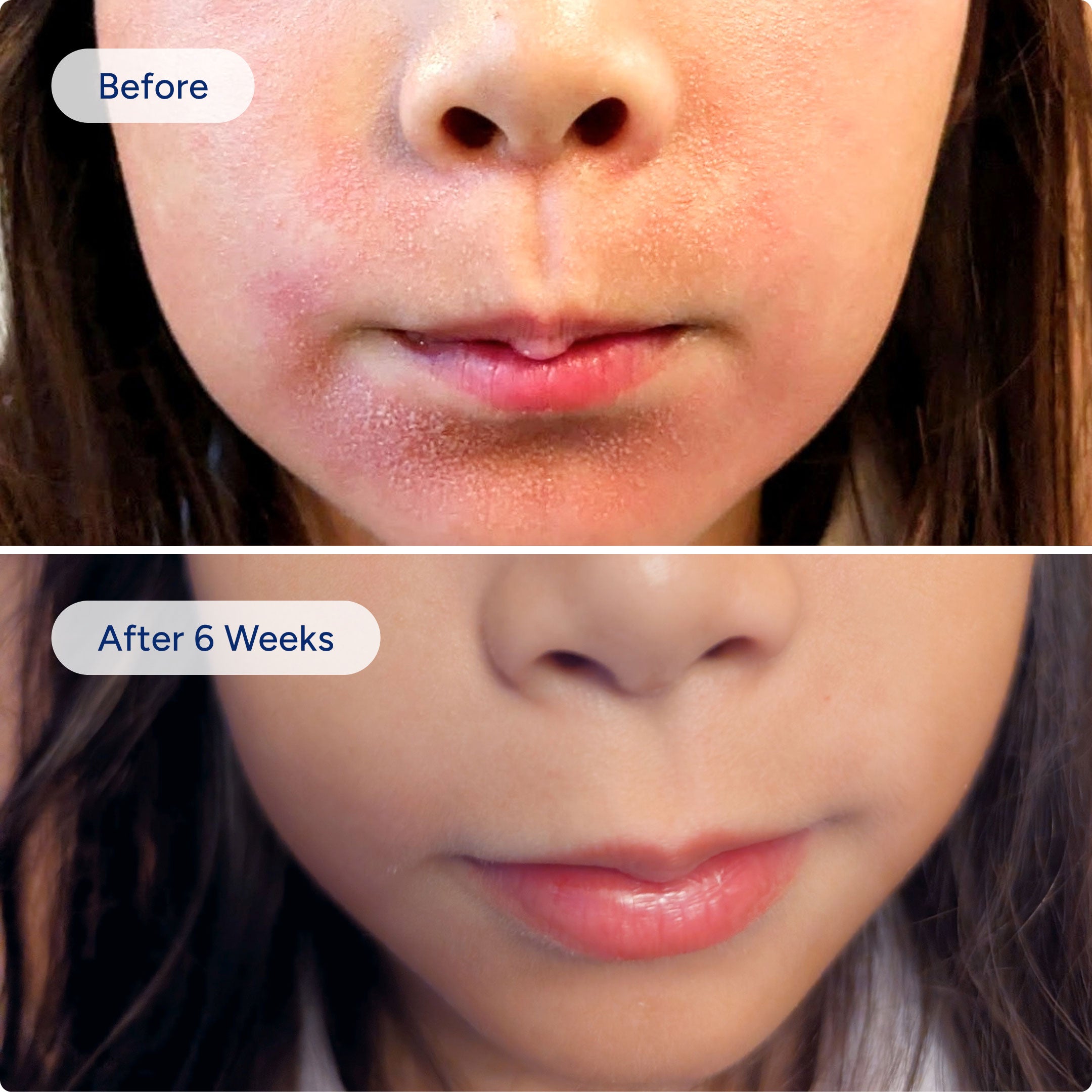 Eczema Relief Kit